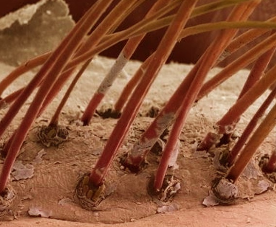 eyelash mites on hair follicles